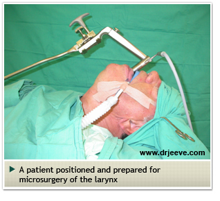 Microsurgery-Larynx