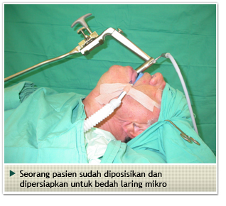 Microsurgery-Larynx