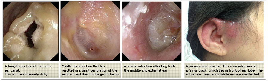 Parathyroid