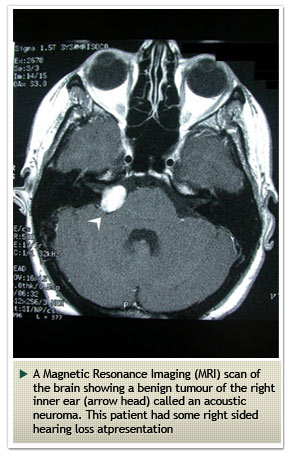 Parathyroid