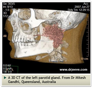 Salivary Gland