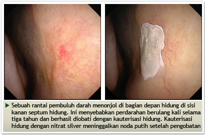 Allergy, Nose and Sinuses