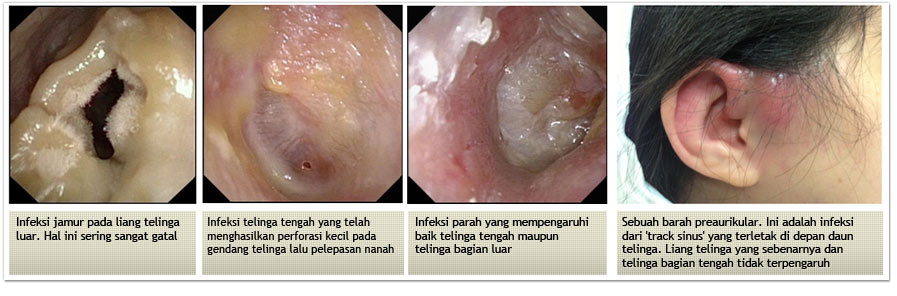 Parathyroid