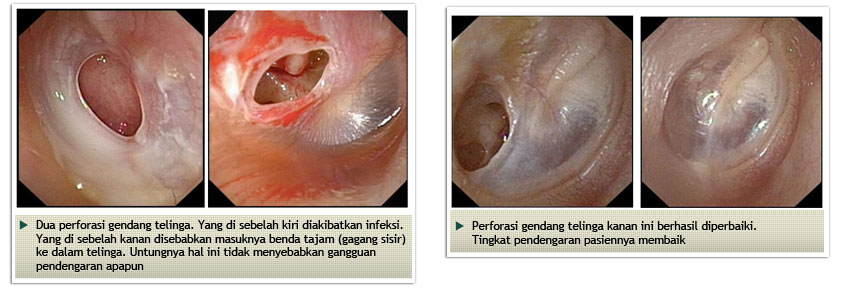 Parathyroid