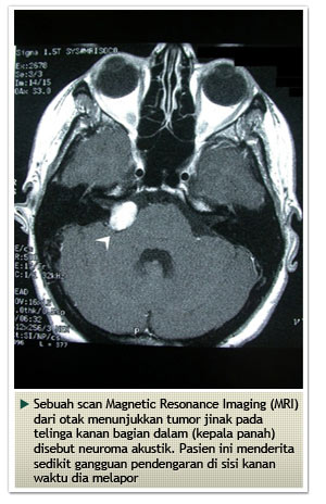 Parathyroid