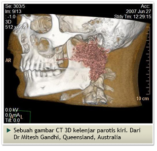 Salivary Gland