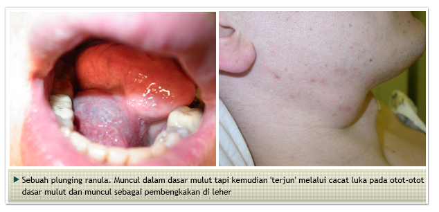 Salivary-Gland